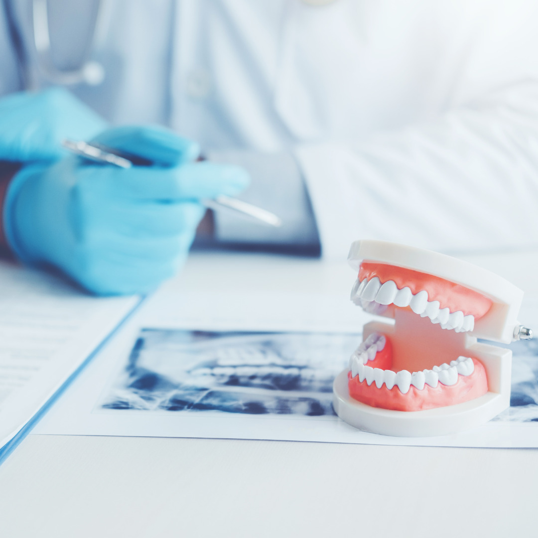 A model of teeth on a dentist's desk